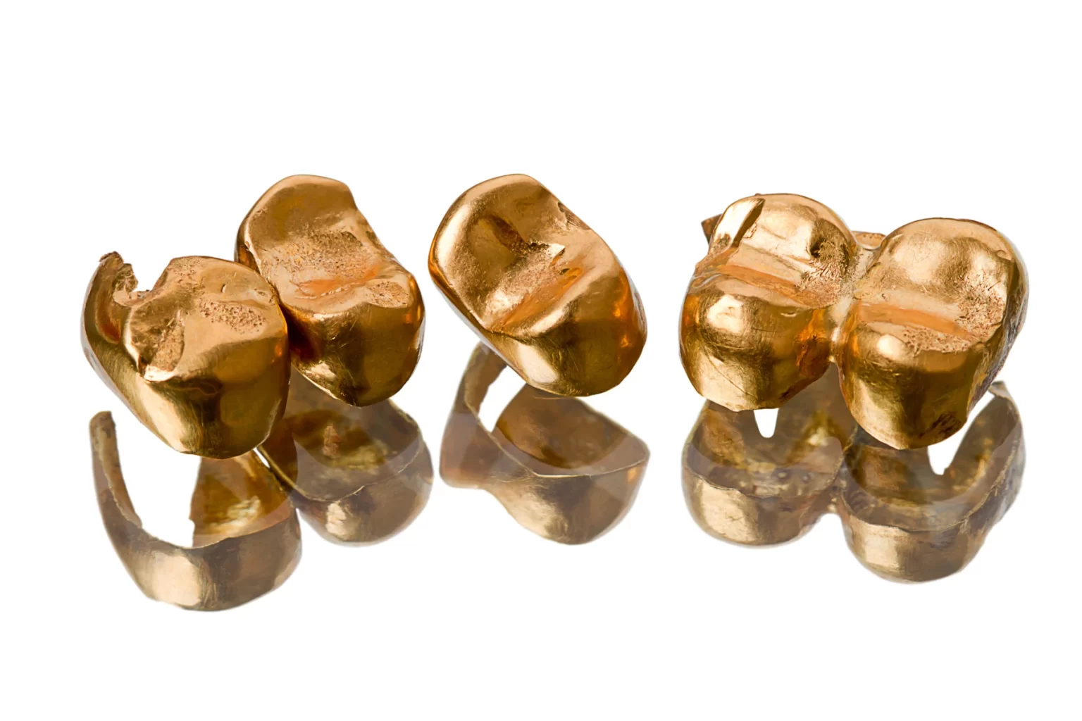 gold-crowns-in-mexico