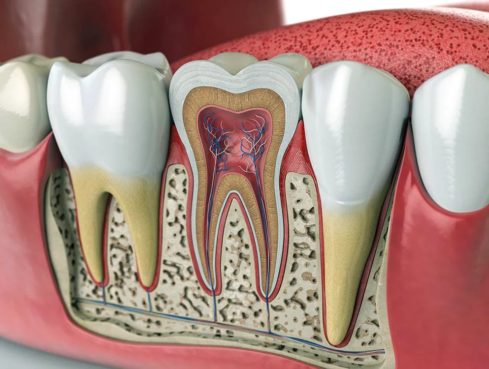 molar-therapy-root-canal