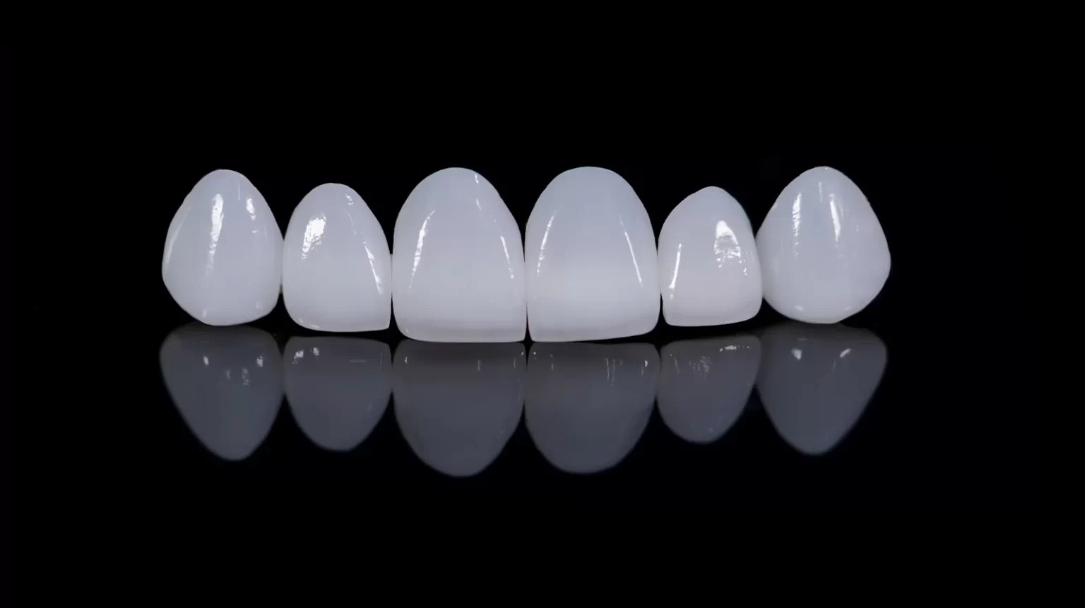 porcelain-dental-veneers