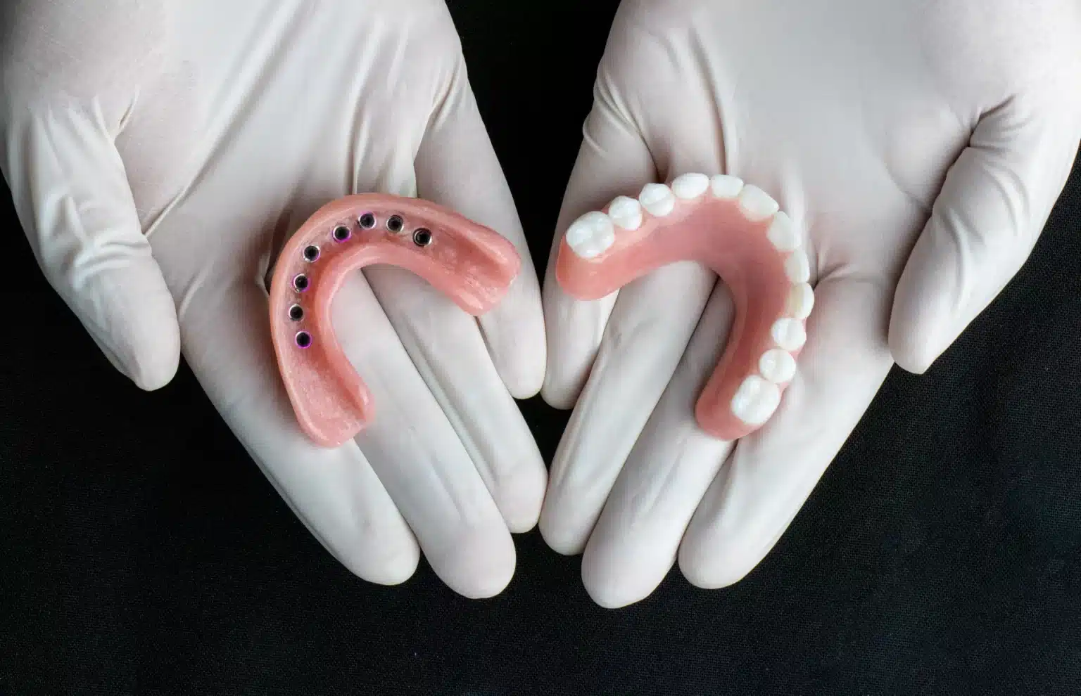 snap-in-dentures-model (7)