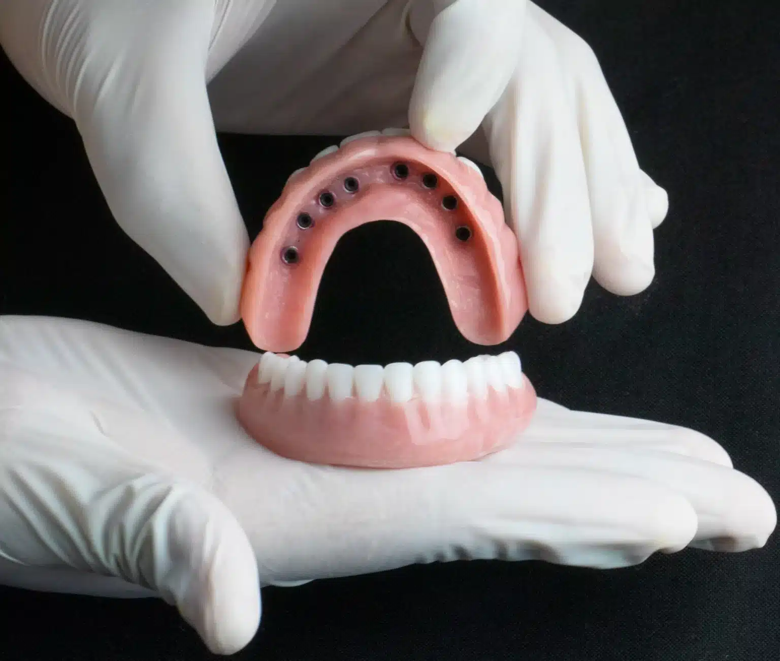 snap-in-dentures-model (8)
